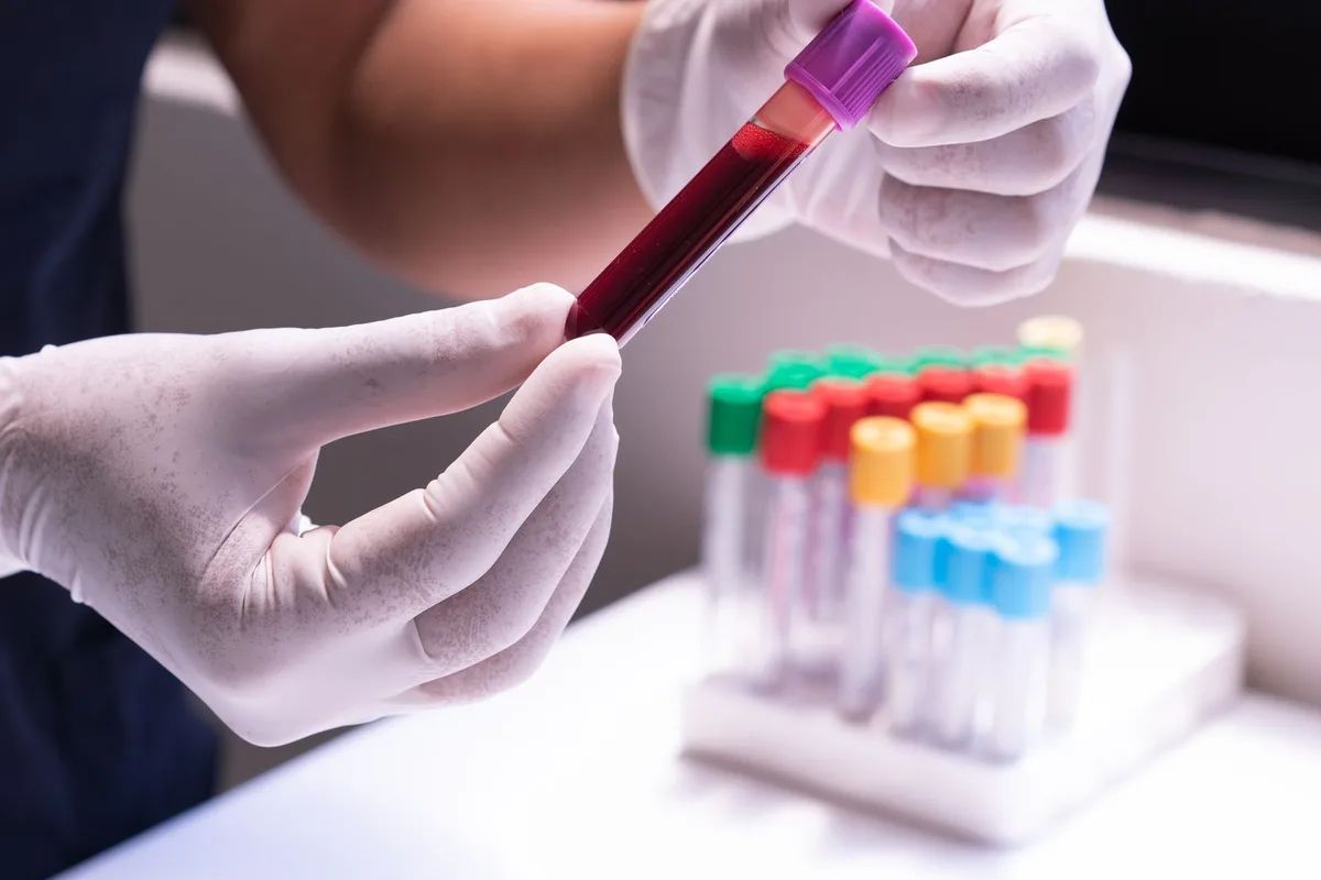 A gloved healthcare worker holding blood sample test tubes. Stock photo.